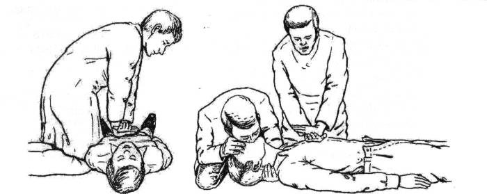 Что в себя включает Сердечно-легочная реанимация