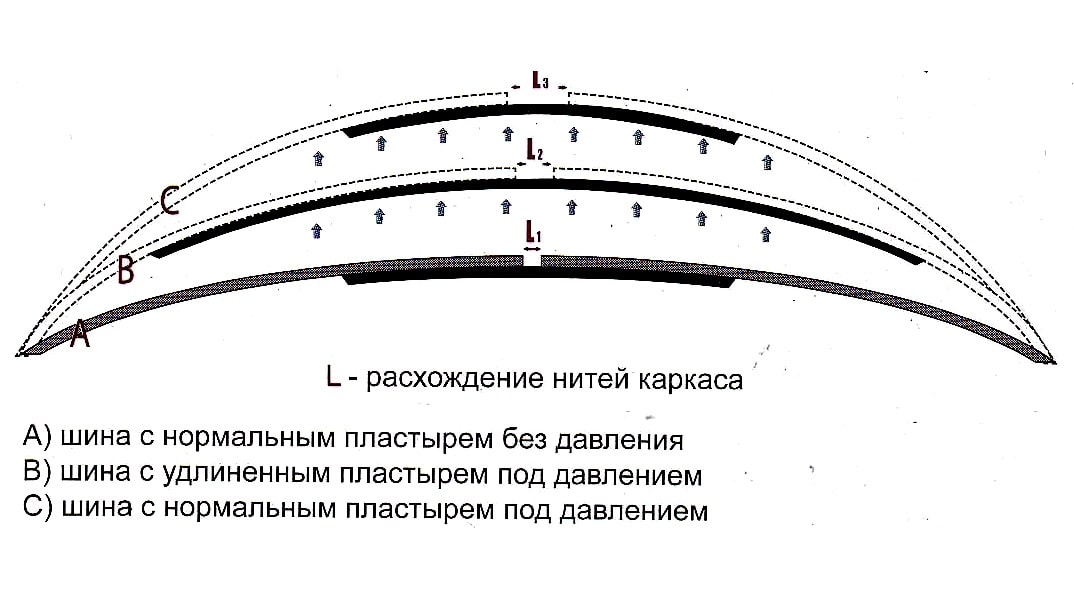 Ремонт пластырем Механизм появления грыжи